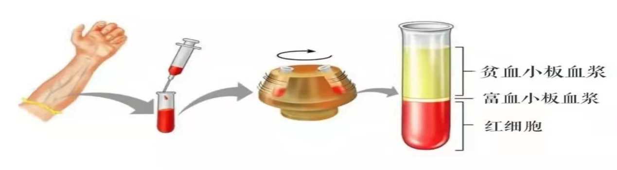 202503301520218558.Png